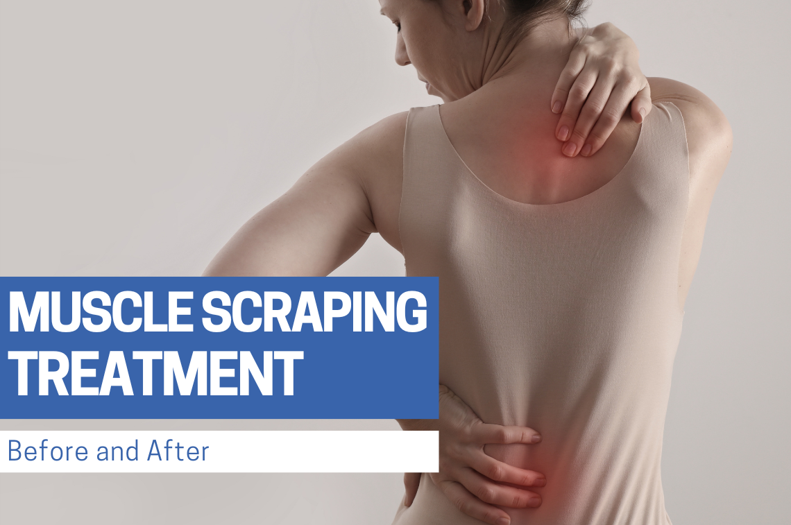 Muscle Scraping Before and After Treatment | Bynatic